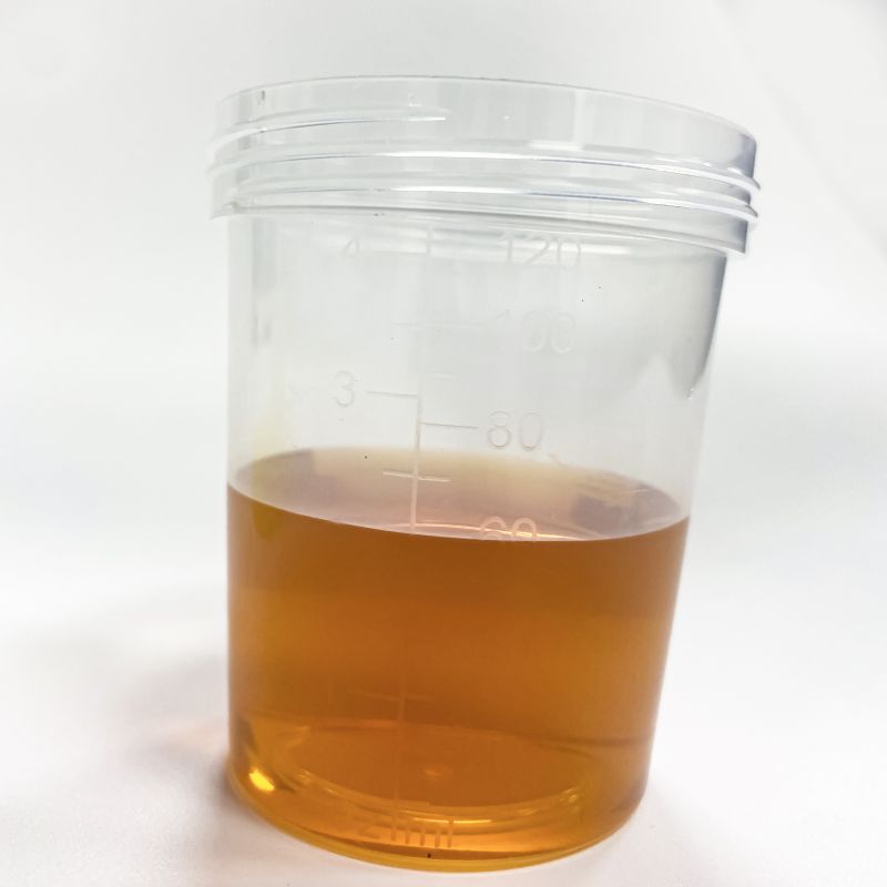 60ml vacuum urine container urine measurement container