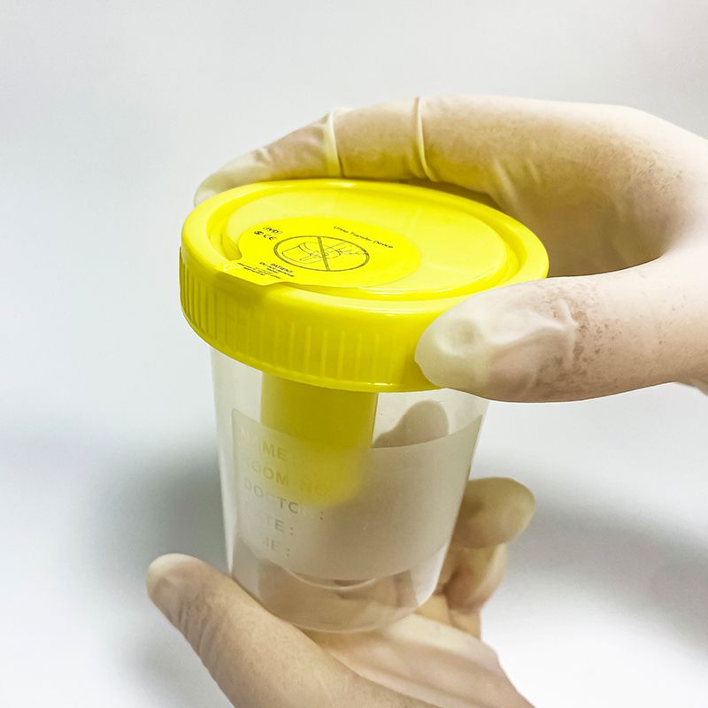 Vacuum urine tube 7ml sarstedt urine container