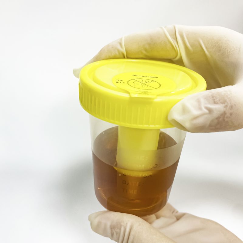 urine container boots lab