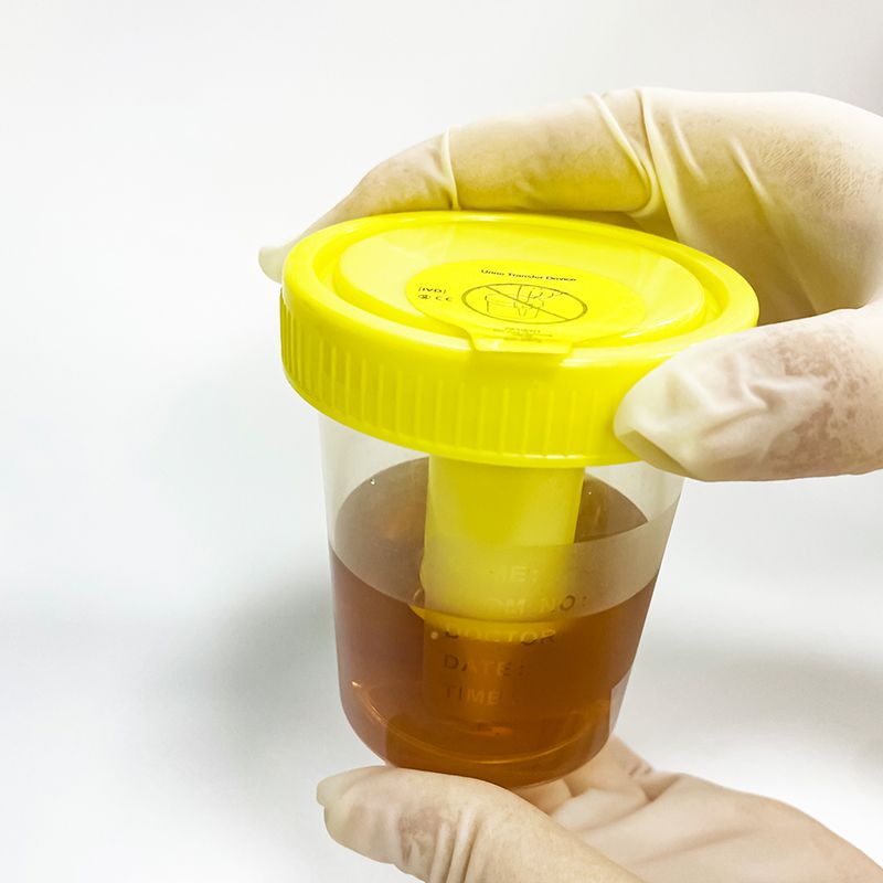 Vacuum urine container